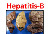 NATURAL PRODUCTS FOR HEPATITIS B/C SOLUTION