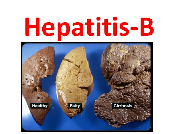 NATURAL PRODUCTS FOR HEPATITIS B/C SOLUTION